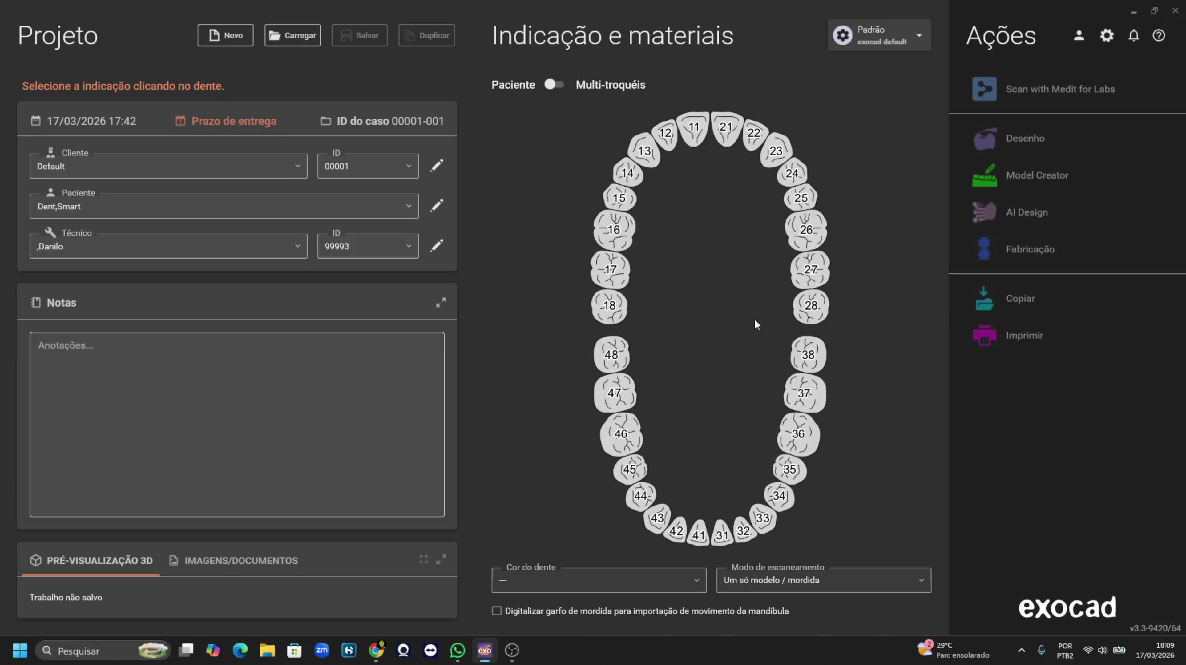 Coroa sobre Implante com IA: Exocad DentalCAD